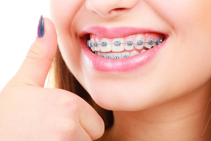 https://www.swastikdentalcare.com/images/services/orthodontic-treatment.jpg